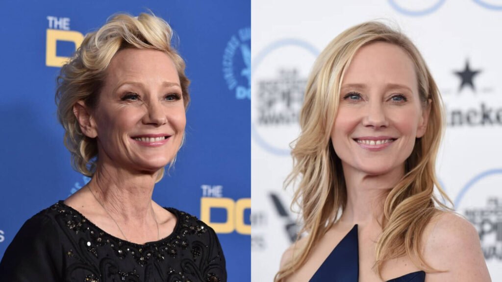 Anne Heche Unfall – Der tragische Vorfall, Hintergründe und Folgen Anne Heche Unfall – Der tragische Vorfall, Hintergründe und Folgen